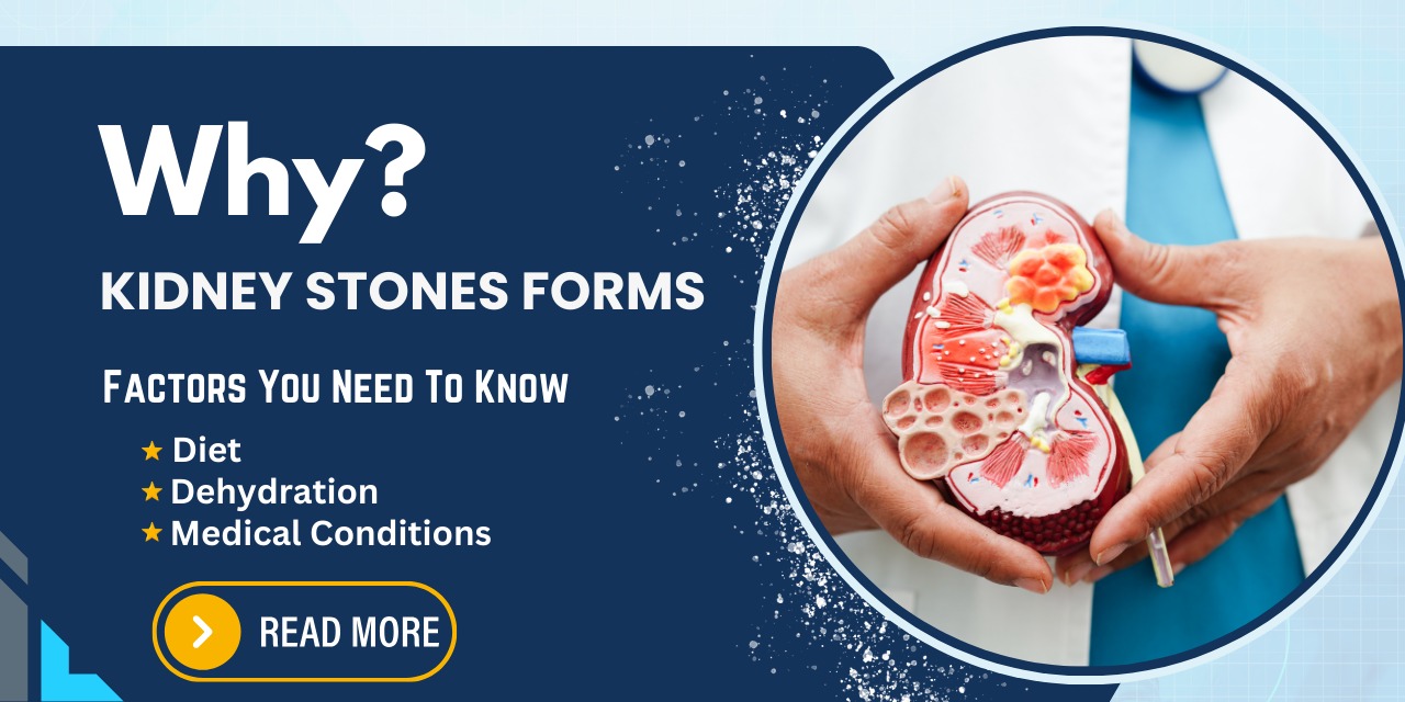 Why Do Kidney Stones Form and How Can You Treat Them?