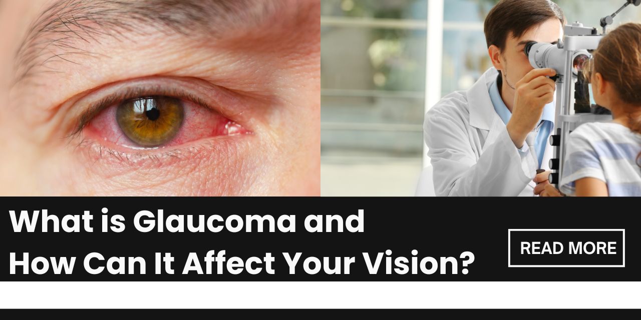 Understanding Glaucoma: Causes, Symptoms, and Risk Factors