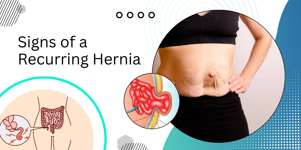 Common Symptoms of a Recurring Hernia