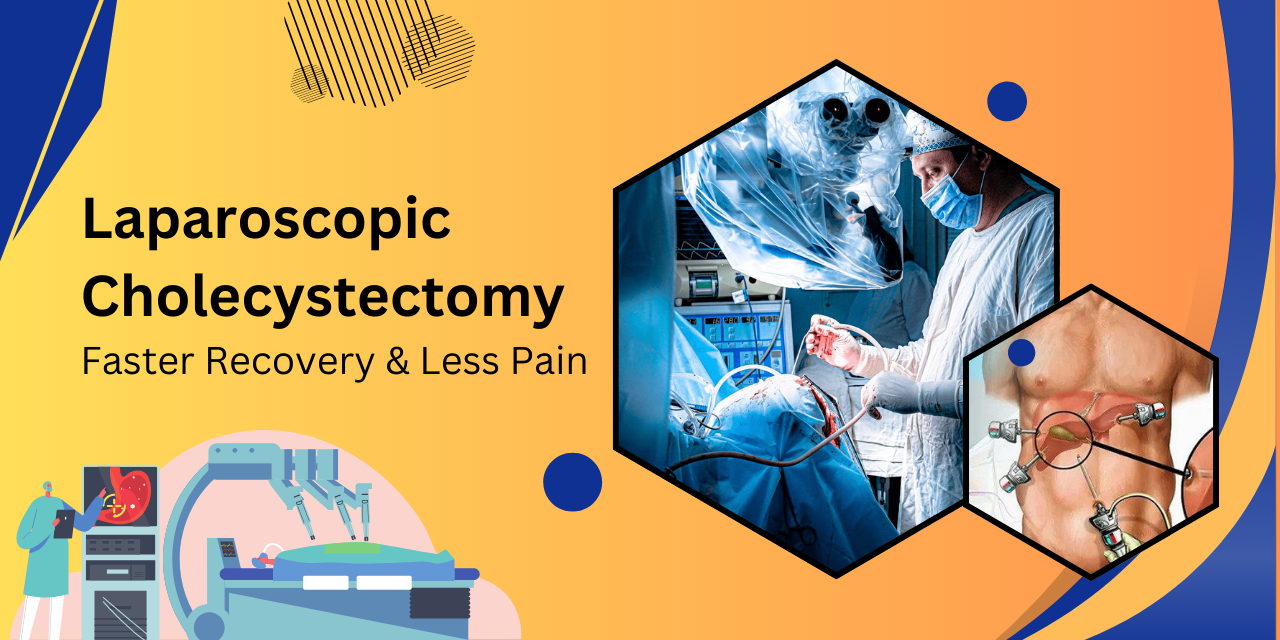 Laparoscopic Cholecystectomy