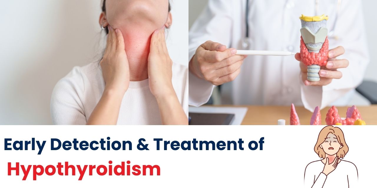 Understanding Hypothyroidism: Causes, Symptoms, and Treatment Options