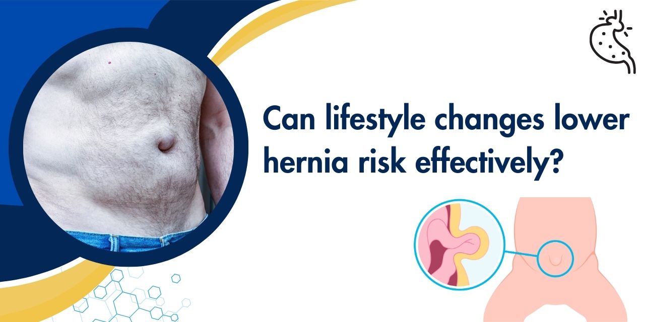 Hernia Prevention: Can Lifestyle Changes Reduce the Risk?