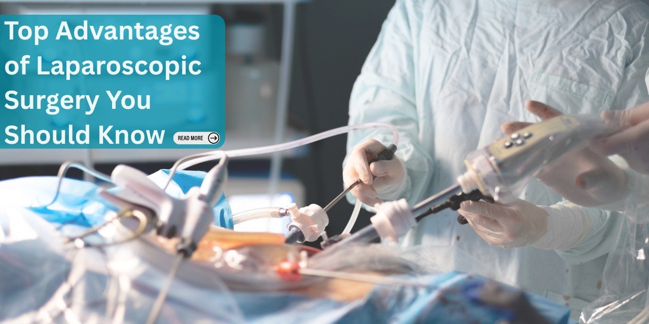 Top Advantages of Laparoscopic Surgery You Should Know